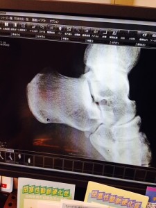 左側がかかと、下のほうに少しひびが。